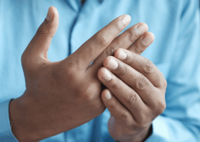 Predicting patient response to arthritis treatment