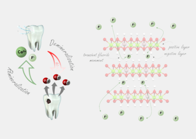 FluoRight: Slow release of fluoride